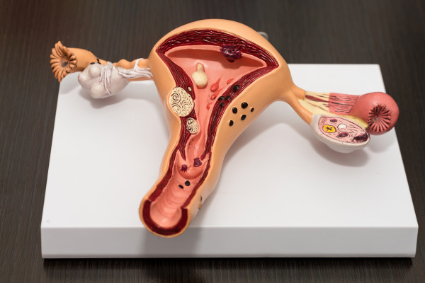 Por qué acudir a la clínica de VPH